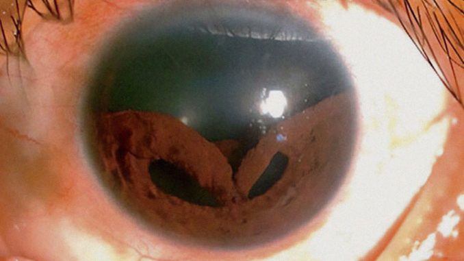46 Amazing Medical Cases That Are Interesting And Bizarre At The Same Time (New Pics)