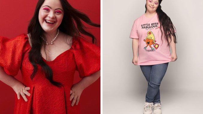 Woman With Down’s Who Was Given 0 Prospects At Birth Now Models For Gucci And Vogue