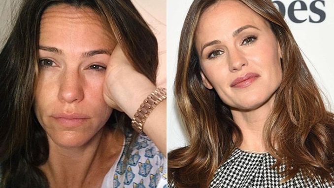These Beautiful Famous Women Has Nothing To Hide, Just Look At Their Natural Look Selfies