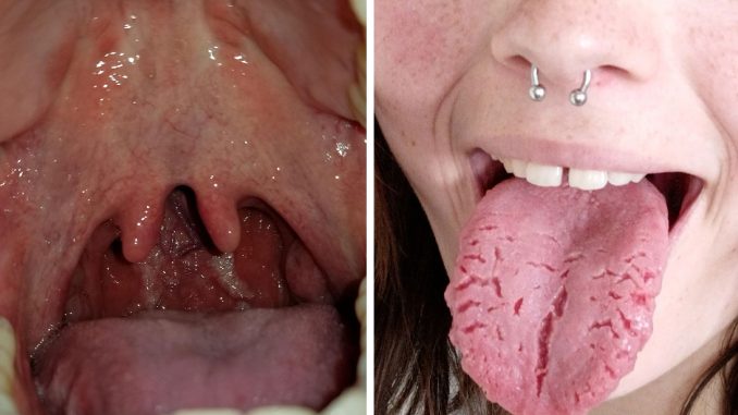 “I Have A Third Nipple”: 81 People Confess About Their Unique Features They Thought Everybody Had