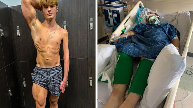 “I Gave Myself A Goal”: A 19-Year-Old Praised After Revealing Why Only One Of His Arms Is Jacked