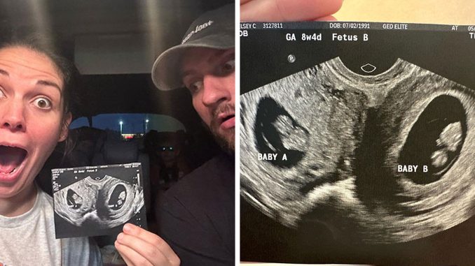 Woman With Condition Affecting “1 In 50 million” People Is Pregnant In Two Separate Uteri