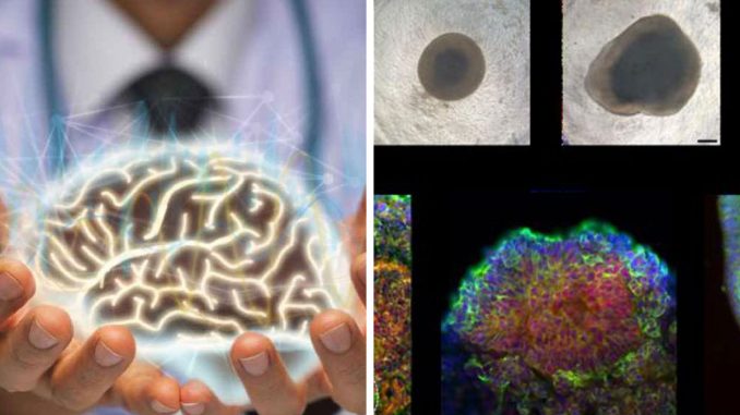 “Exciting Future”: Scientists Combine Hardware With Lab-Grown Human Tissue To Create “Biocomputer”