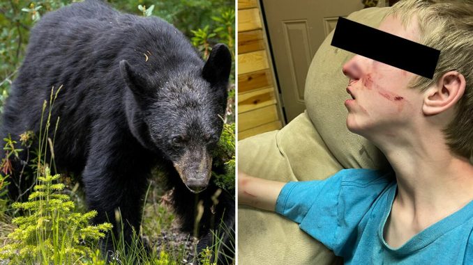 15-Year-Old Boy With Rare Neurological Disorder Mauled By Bear While Watching TV