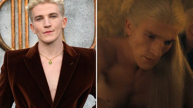 House Of The Dragon Star Ewan Mitchell Reveals He Refused Prosthetic, Wanted To Be “Fully Nude”