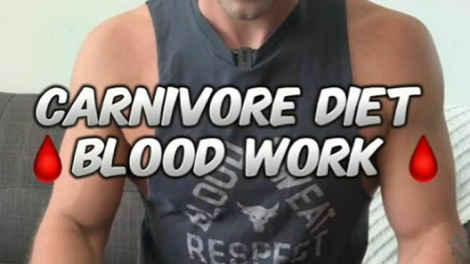 Influencer’s High Cholesterol Raises Alarms After 1 Year On Controversial Carnivore Diet