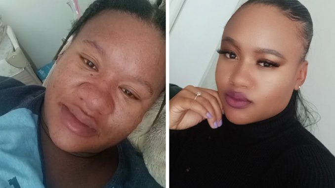 Netizens Stunned By Woman’s Dramatic Pregnancy Transformation: “Are You Sure That’s You?”