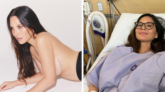 “A Warrior!”: Olivia Munn Praised For Proudly Showing Mastectomy Scars In New Photoshoot