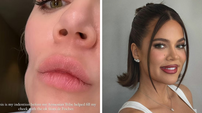 “Horribly Stitched”: Khloe Kardashian Posts Unsettling Pictures Of Her Plastic Surgery