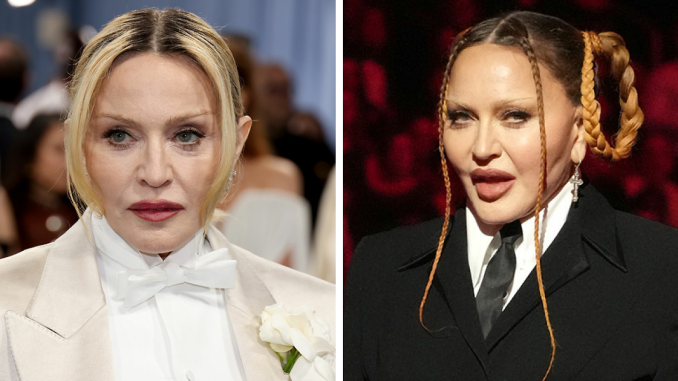 66YO Madonna Brings Back Natural Look At Met Gala 2025 After Concerning Plump Cheeks And Pout