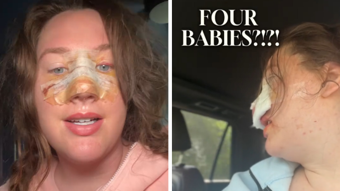 Mom Wakes From Surgery, Totally Unprepared For How Many Kids She Gave Birth To