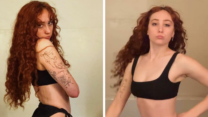 “The Way My Jaw Dropped”: Chappell Roan Praised After Showing Off Her “Healthy” Body