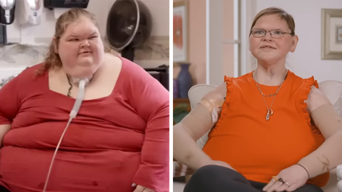 Shocking Transformation Of ‘1000-lb Sisters’ Star Goes Viral After She Reveals ‘Terrifying’ 8-Hour Surgery