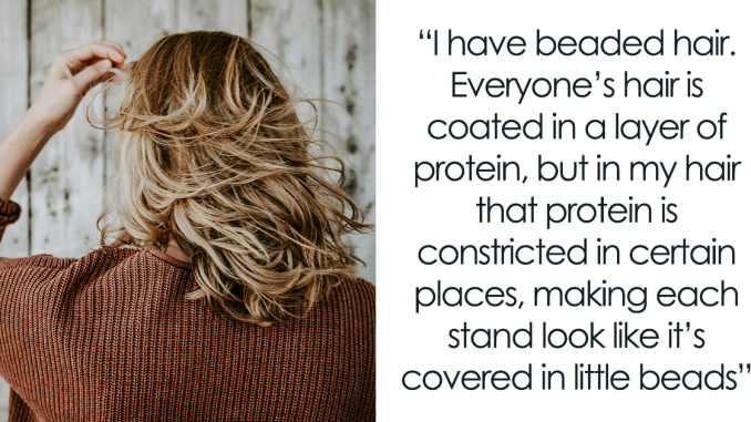 20 Netizens With Various ‘Medically Cool’ Body Traits Share Things They Are Happy (Or Not) To Have