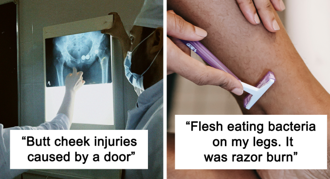 “What Is The Stupidest Reason You Went To Hospital?” (20 Answers)