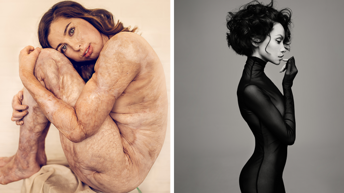 Budapest International Photo Awards Winners Of 2021, And They’re Truly Powerful (20 Pics)