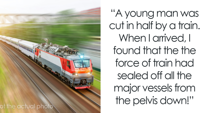 Medical Professionals Can’t Believe These 70 People Survived After Seeing Their Condition