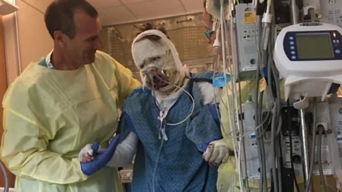 Woman Burned In Gas Station Explosion Stuns The Internet With Transformation 6 Years Later