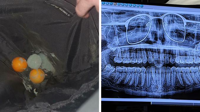 62 Times People Forgot Something And Ended Up In Funny Unfortunate Situations (New Pics)