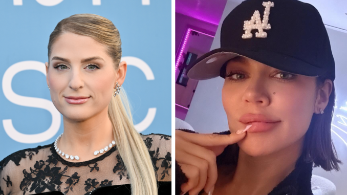 15 Before-And-After Photos Of Celebs Who Replaced Regular Botox With “Lip Flip” For A New Kind Of Look