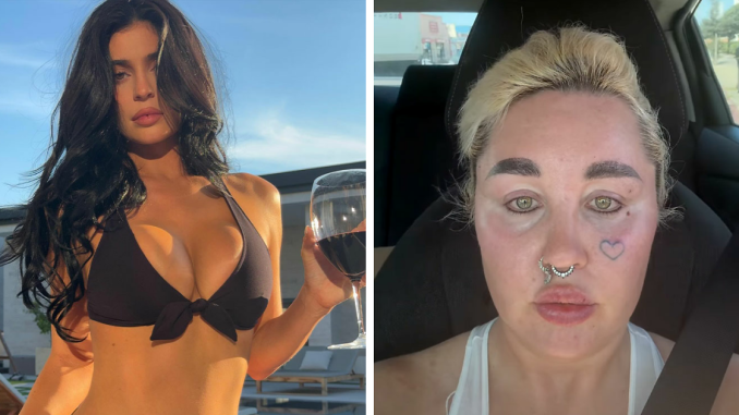 Amanda Bynes Shows Off Dramatic Change After Controversial Kylie Jenner Style Procedure