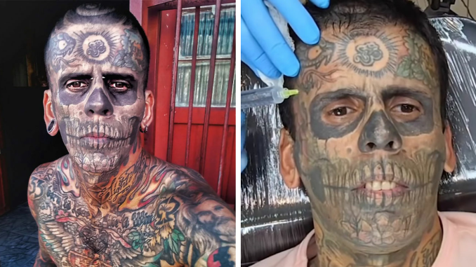 “Brazilian Steve-O”: 95% Tattooed Man Reveals His Dramatic New Look After Tattoo Removal