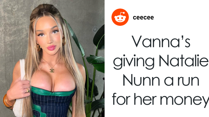 ‘Love Island Face’ Trend Sparks Concern As Plastic Surgery Experts Warn Against ‘Filler Blindness’