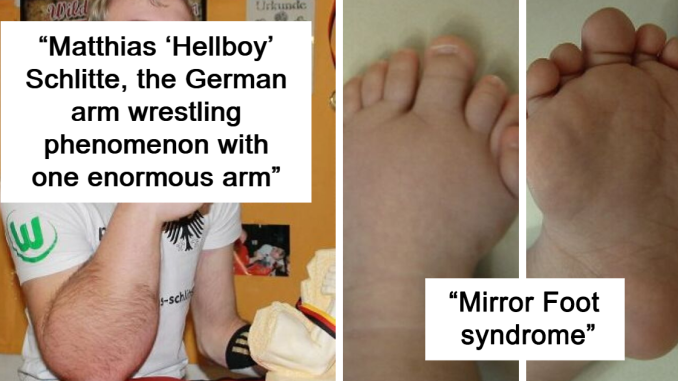 42 Photos Of Human Body Quirks That Are Both Fascinating And Shocking